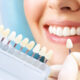 faccette dentali verona studio dentistico dieffe